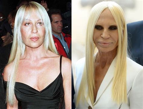 duna stella versace|donatella versace before and after.